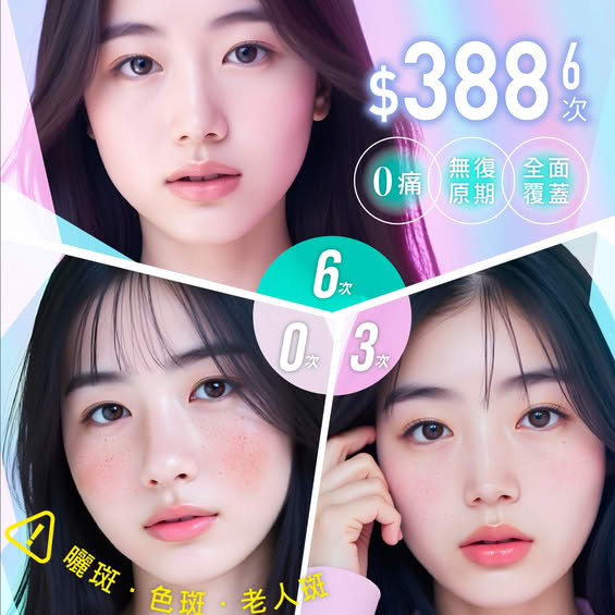 pico 超皮秒激光去斑